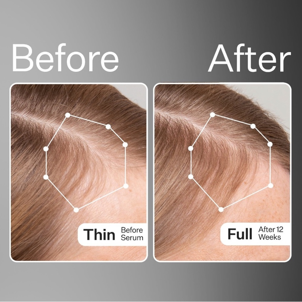 🍃 ACT+ACRE Cold Processed Stem Cell Scalp Serum 30ml - Picture 4 of 12